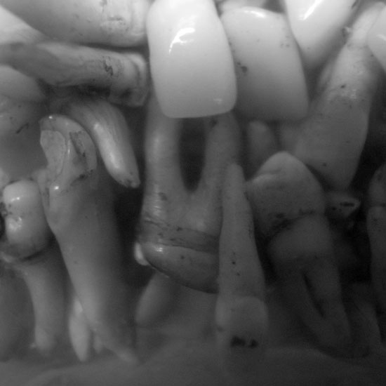 teeth